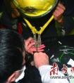 又见熊孩子戴“魔戒”8岁男童被轴承圈卡住手指