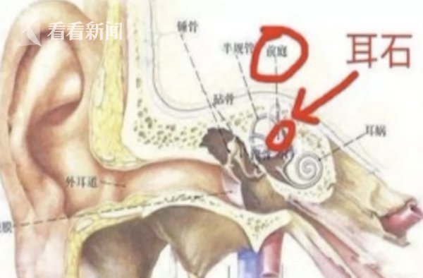 太意外！用筋膜枪放松肌肉竟把自己打晕 还有意外“收获”