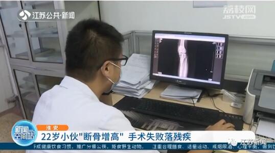不靠谱！小伙断骨增高失败面临终身残疾 断骨增高有科学依据吗？
