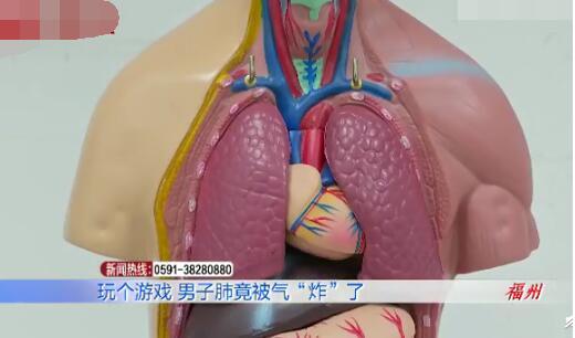 怒气冲天！男子打游戏4小时连输肺气炸 原来肺真的会气炸