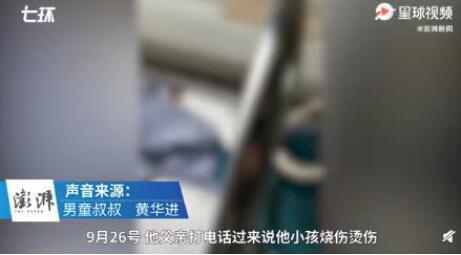不配为人父！男童遭亲父烟头烫伤双手面临截肢，满身伤疤！