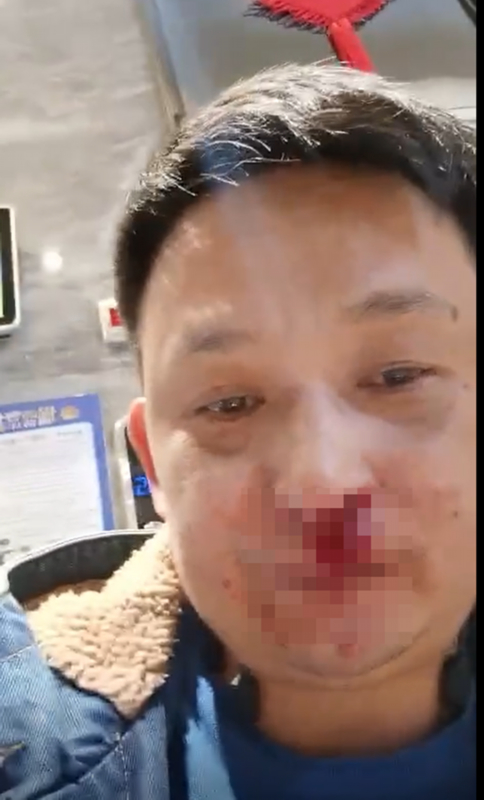 男子电梯里让路反被打骨折 打人者背景强大欲私了？