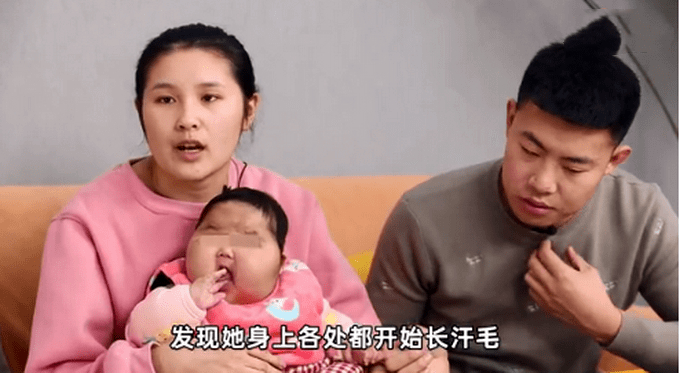 5个月婴儿成“大头娃娃”!厂家不认可家属送检结果