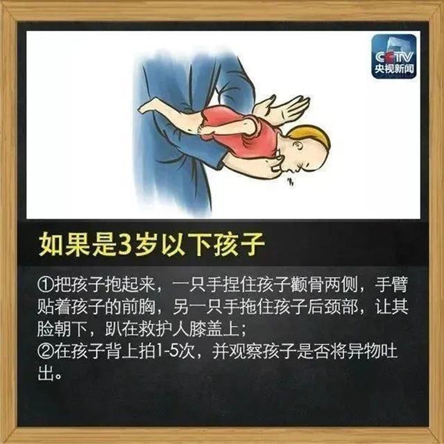 医生在电梯内20秒挽救卡喉窒息的3岁女童!这种急救法每个人都应该学会