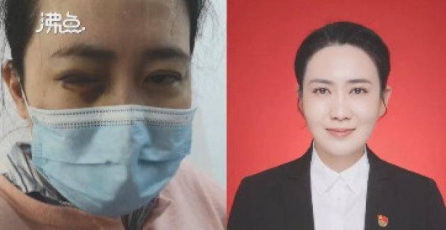 抗疫医生艾芬:已实名举报爱尔眼科 事件详情始末是什么?