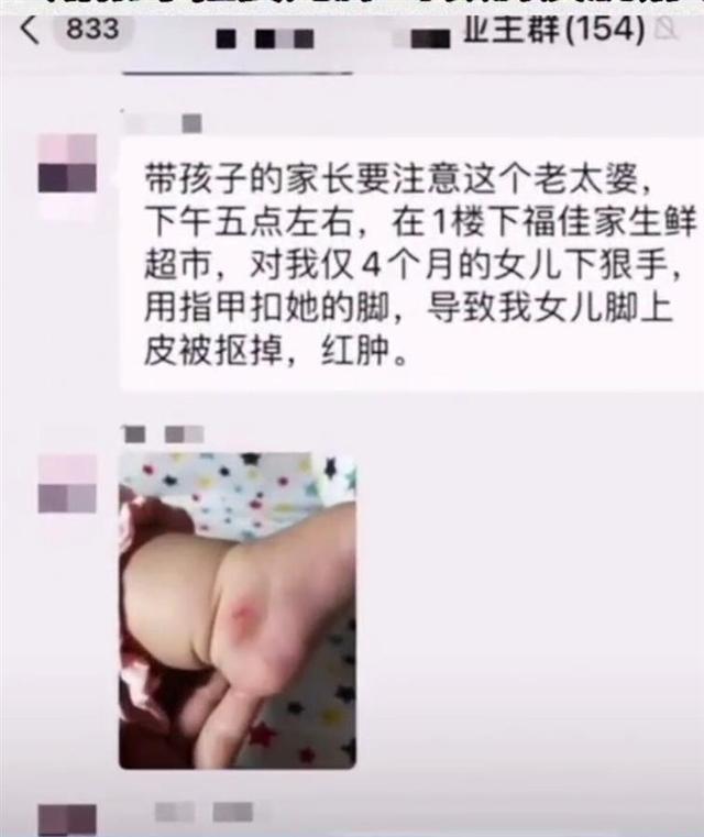 不满婴儿车挡道,一大妈竟抠掉婴儿脚皮,现已被厦门警方拘留