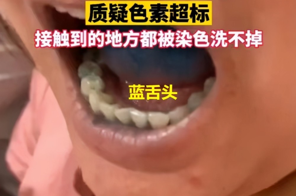 网红蛋糕吃完牙变蓝,已将蛋糕送到检测中心,店家回应了吗?
